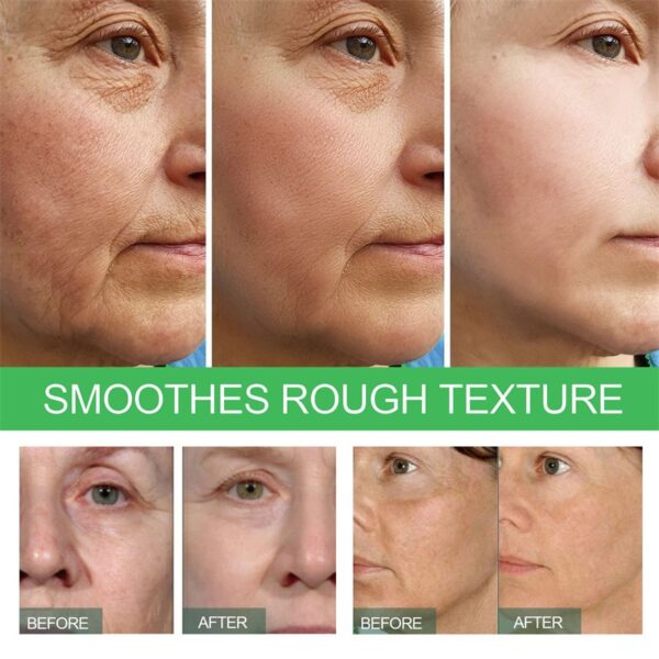 Removedor instantâneo de rugas Soro facial, Lifting, Firming, Fade Fine Lines, Anti-Envelhecimento, Essência, Clareamento, Iluminar - Image 5