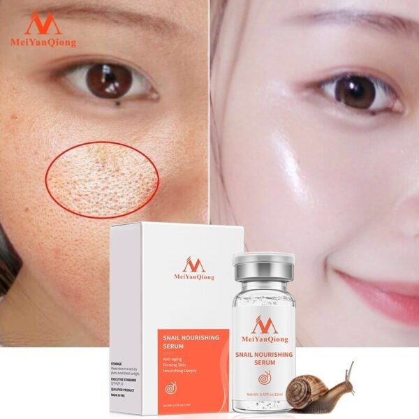 Ampola de ácido hialurônico, Clareamento Líquido, Essência Spot, Poros Encolhedores, Anti-Acne, Essência Regenerativa, Poro, 100% - Image 6