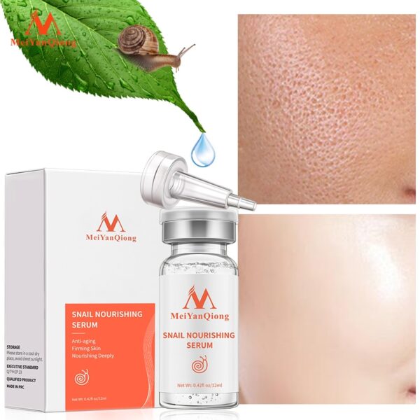 Ampola de ácido hialurônico, Clareamento Líquido, Essência Spot, Poros Encolhedores, Anti-Acne, Essência Regenerativa, Poro, 100%