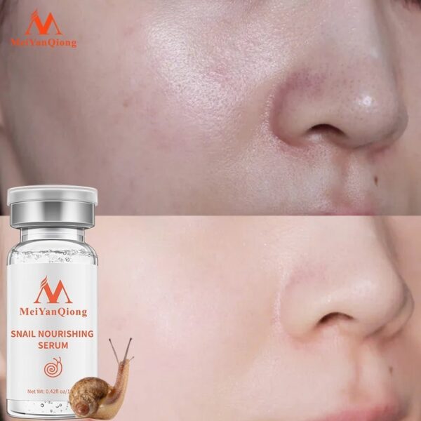 Ampola de ácido hialurônico, Clareamento Líquido, Essência Spot, Poros Encolhedores, Anti-Acne, Essência Regenerativa, Poro, 100% - Image 5