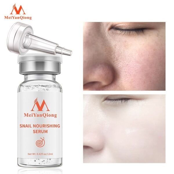 Ampola de ácido hialurônico, Clareamento Líquido, Essência Spot, Poros Encolhedores, Anti-Acne, Essência Regenerativa, Poro, 100% - Image 3