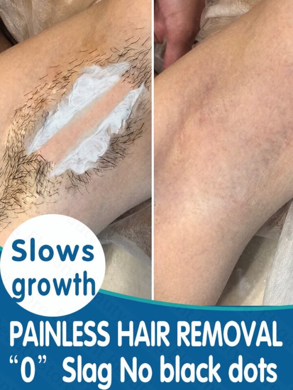 Creme permanente da remoção do pelos, creme depilatório indolor, cara, pé, zona dos cuidados com a pele,  senhoras, homens, mulheres, axilas, corpo íntimo
