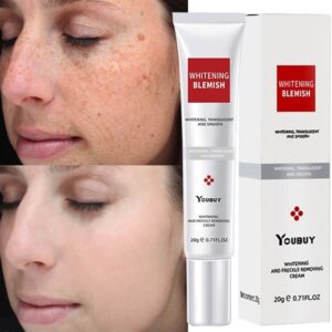 Creme facial de Sardas, de Clareamento Eficaz, Melasma Remover Manchas Escuras, Melanina, Hidratar, Iluminar o Rosto Suave, Cuidados Com A Pele