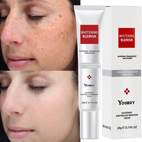 Creme facial de Sardas, de Clareamento Eficaz, Melasma Remover Manchas Escuras, Melanina, Hidratar, Iluminar o Rosto Suave, Cuidados Com A Pele