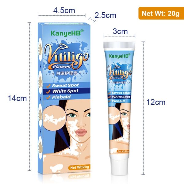 Creme/pomada, Herbal Vitiligo extrato, Remover Micose, Remoção de mancha branca, Pele mancha branca, Leucoplasia doença tratamento creme, 20g - Image 6