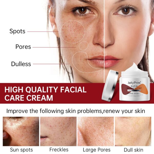 Creme facial clareador nicotinamida, removedor de pigmentos, cremes clareadores, hidratantes, produtos para cuidados com a pele, manchas escuras - Image 3