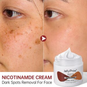 Creme facial clareador nicotinamida, removedor de pigmentos, cremes clareadores, hidratantes, produtos para cuidados com a pele, manchas escuras