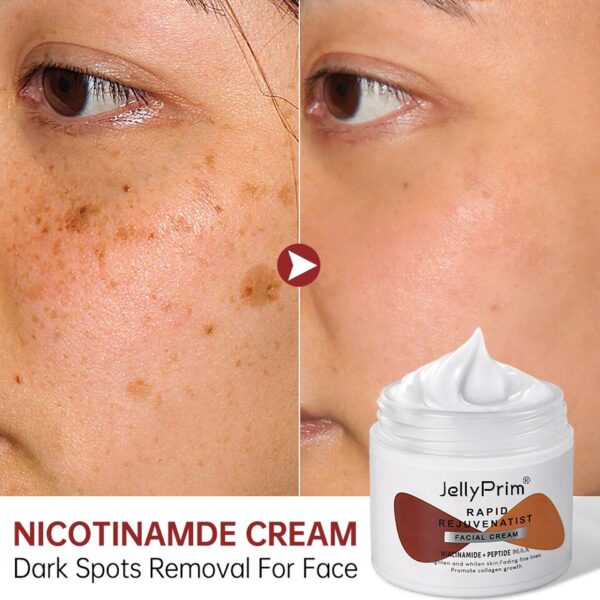 Creme facial clareador nicotinamida, removedor de pigmentos, cremes clareadores, hidratantes, produtos para cuidados com a pele, manchas escuras