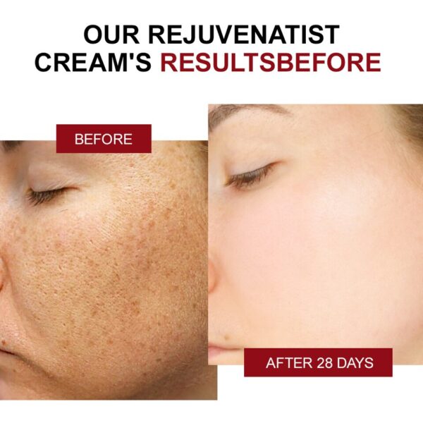 Creme facial clareador nicotinamida, removedor de pigmentos, cremes clareadores, hidratantes, produtos para cuidados com a pele, manchas escuras - Image 2