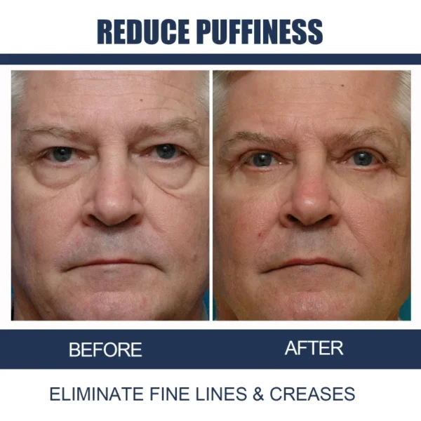 Creme hidratante para os olhos, anti-envelhecimento, desvanecer-se círculos escuros removedor, sacos gel, sob os olhos, cuidados com a pele. - Image 4