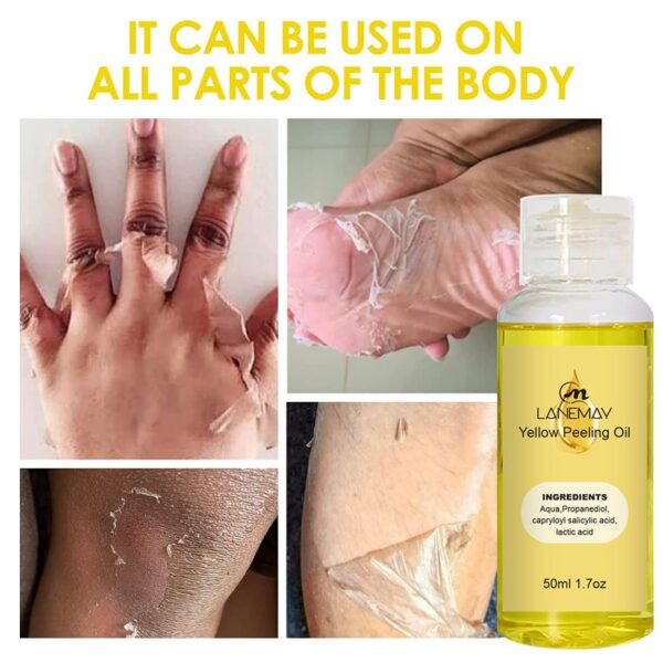 Óleo Amarelo Peeling Oil Branqueamento, esfoliante Dark Skin Spots Remover Dead Skin Lighten Melanin Scrub Hidratação Body Skin Care - Image 2