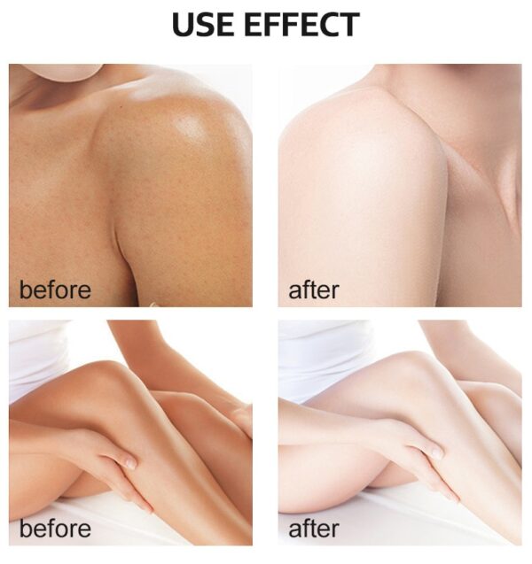 Óleo Amarelo Peeling Oil Branqueamento, esfoliante Dark Skin Spots Remover Dead Skin Lighten Melanin Scrub Hidratação Body Skin Care - Image 8