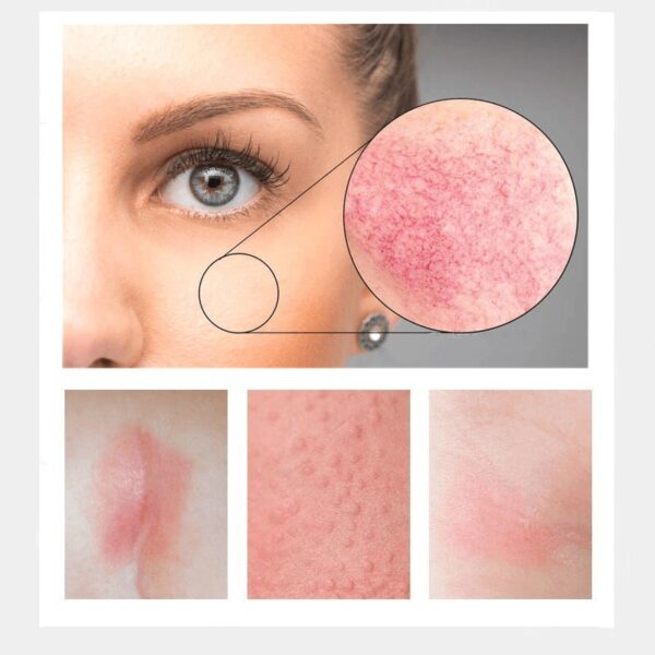 Loção tratamento facial, Caracol Essência, Reparação, Vermelhidão, Pele Seca, Sensível, Hidratante Intenso, Sooth, Cosméticos Korean Care - Image 8
