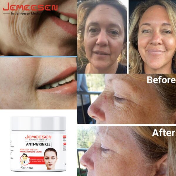 Creme refirmante, Jemeesen-Retinol, Lifting, Anti-Envelhecimento, Remover Rugas, Fade Linhas Finas, Face Whitening, Iluminar a Pele, Beleza, Cuidados de Saúde - Image 2