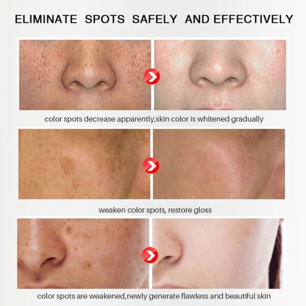 Creme facial retinol Whitening, Remover Rugas, Remoção de sardas, Tratamento Anti-Acne, Desvanecer-se Linhas Finas, Cuidados com a pele - Image 5