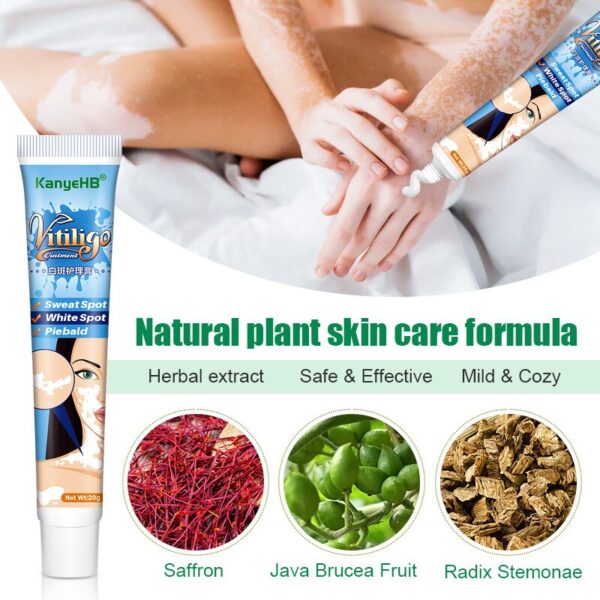 Creme/pomada, Herbal Vitiligo extrato, Remover Micose, Remoção de mancha branca, Pele mancha branca, Leucoplasia doença tratamento creme, 20g - Image 5
