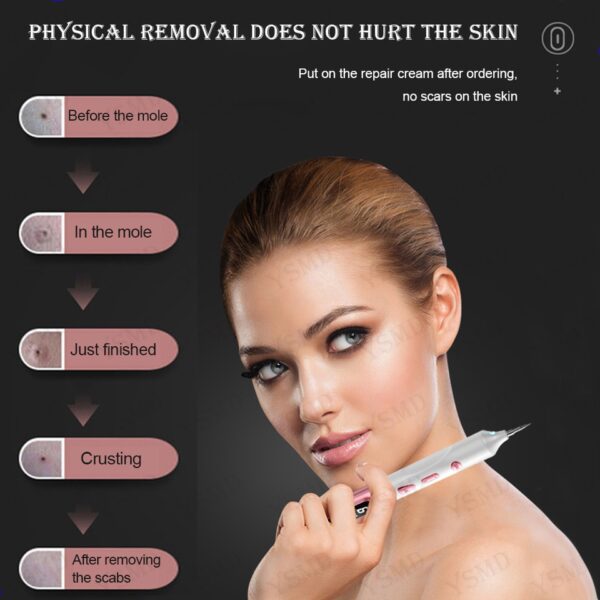 Caneta Plasma Laser para Removedor de Tag da Pele, Sarda, Ponto Preto, Papiloma, Verrugas, Toupeira, Espinhas, Remoção de Tatuagem - Image 11