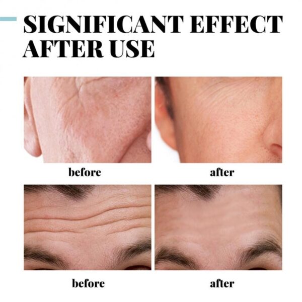 Creme facial para homens, Colágeno anti rugas, Ácido hialurônico, Vitamina E Creme, Hidratante rosto cuidados com a pele produto, Fade Fine Lines, Beleza - Image 9