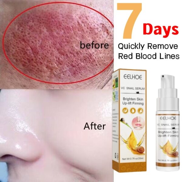 Loção tratamento facial, Caracol Essência, Reparação, Vermelhidão, Pele Seca, Sensível, Hidratante Intenso, Sooth, Cosméticos Korean Care