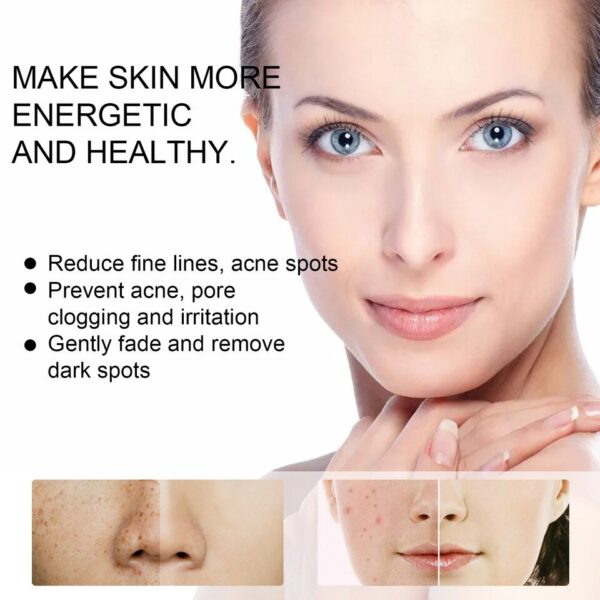 Creme facial retinol Whitening, Remover Rugas, Remoção de sardas, Tratamento Anti-Acne, Desvanecer-se Linhas Finas, Cuidados com a pele - Image 8