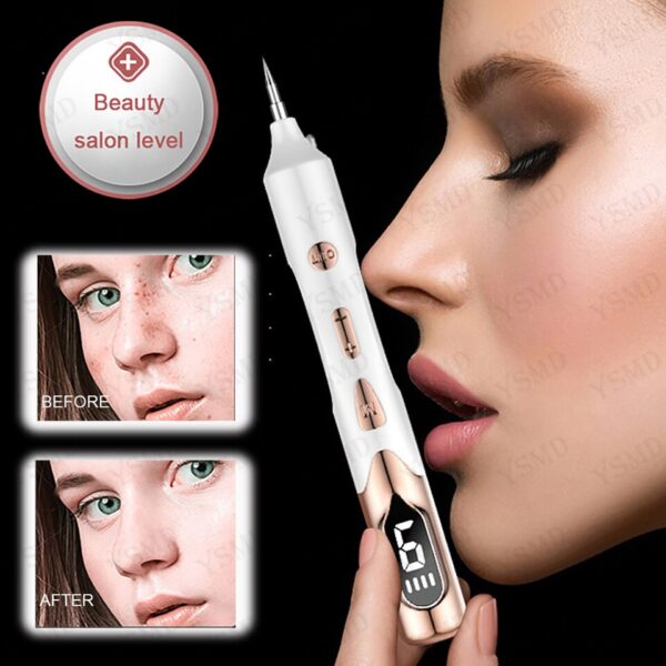 Caneta Plasma Laser para Removedor de Tag da Pele, Sarda, Ponto Preto, Papiloma, Verrugas, Toupeira, Espinhas, Remoção de Tatuagem - Image 5