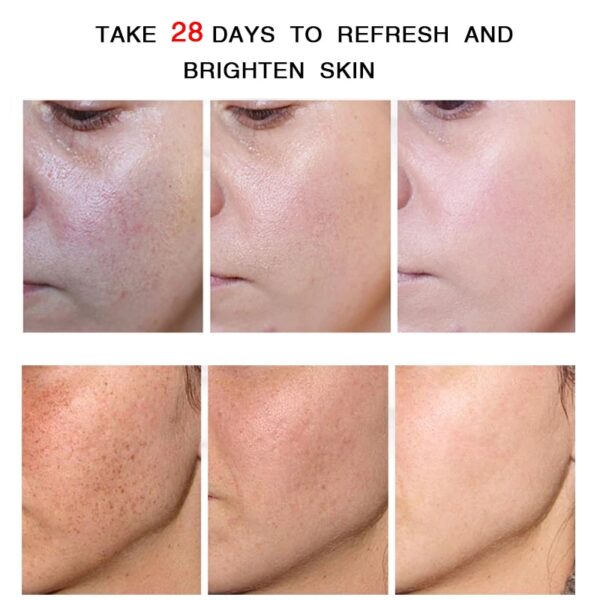 Creme facial retinol Whitening, Remover Rugas, Remoção de sardas, Tratamento Anti-Acne, Desvanecer-se Linhas Finas, Cuidados com a pele - Image 7