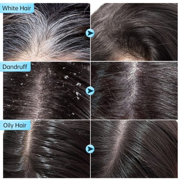 Shampoo em barra, cabelo Branco Escurecimento, Sabão De Bambu, Limpeza De Carvão, Anti Caspa, Espuma De Tratamento De Cabelo, Shampoos Sólidos, Barra - Image 7