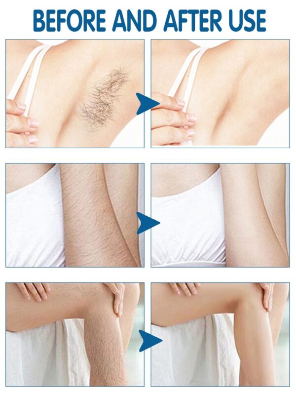 Creme permanente da remoção do pelos, creme depilatório indolor, cara, pé, zona dos cuidados com a pele,  senhoras, homens, mulheres, axilas, corpo íntimo - Image 4