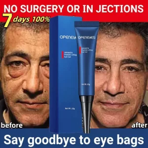 Creme Retinol Anti Rugas Eye Cream masculino, remover bolsas oculares, evitar círculos escuros, desvanecer-se Linha Fina, firme hidratante, reparar cuidados com a pele.