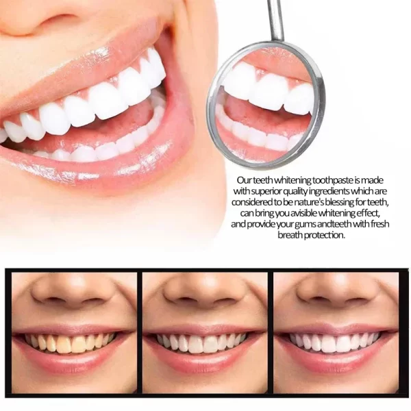 Creme dental, Dentes branqueamento, removedor rápido, manchas de placa, reparar cavidades, prevenir a periodontite, respiração fresca, iluminar, cuidados dentários - Image 2