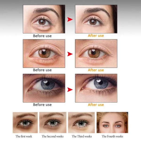 Soro do olho do Anti-enrugamento, Peptide, nutrir, Anti-círculo escuro, sacos do olho, sopro, levantamento, firmando, rolo da pele, massageador, cuidado do olho - Image 5