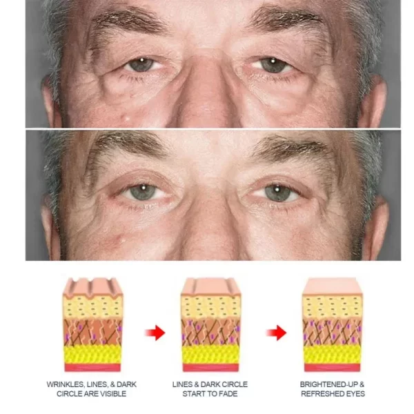 Creme Retinol Anti Rugas Eye Cream masculino, remover bolsas oculares, evitar círculos escuros, desvanecer-se Linha Fina, firme hidratante, reparar cuidados com a pele. - Image 4