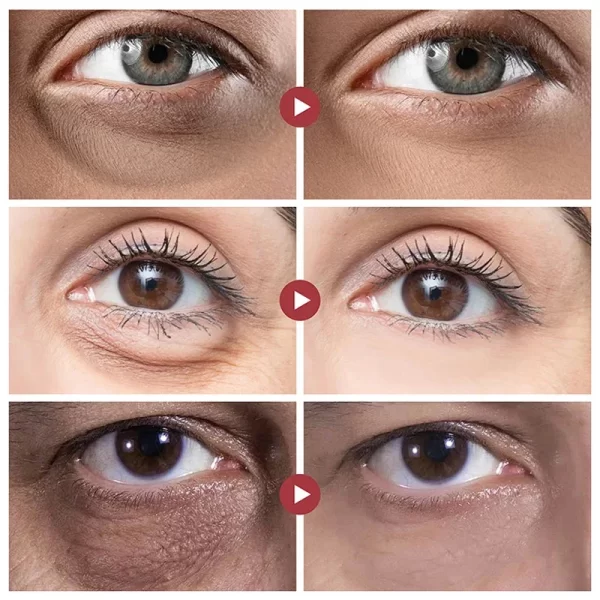 Creme Retinol Anti Rugas Eye Cream masculino, remover bolsas oculares, evitar círculos escuros, desvanecer-se Linha Fina, firme hidratante, reparar cuidados com a pele. - Image 2