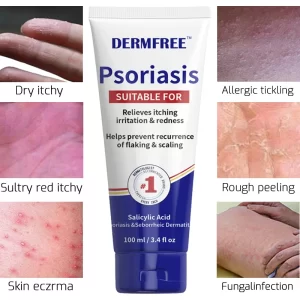Creme Antibacteriano Psoríase, Pomada Eczema, Tratamento da Pele, Dermatite, Odor do Pé comichão, Erva-Medicina, Cuidados Psoríase, 100ml por g