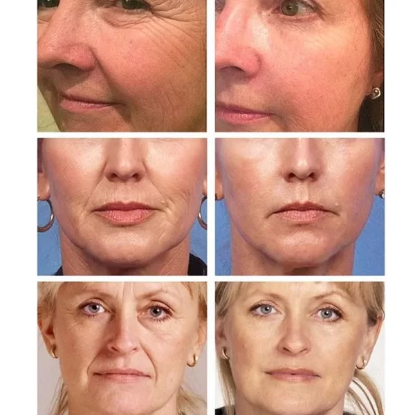Creme rejuvenescedor facial, Caviar Colágeno Anti-Rugas, rugas tratamento Alta Qualidade Eficiente Fade Fine Lines Anti Aging Whitening Produtos de beleza Cosméticos coreanos - Image 6