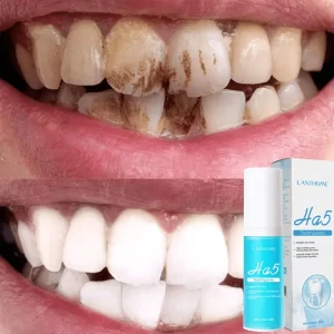 Creme dental, Dentes branqueamento, removedor rápido, manchas de placa, reparar cavidades, prevenir a periodontite, respiração fresca, iluminar, cuidados dentários
