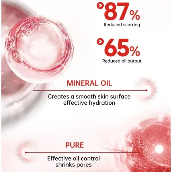 Creme de remoção rápida cicatriz, Reparação de estrias, Queimar Cirurgia, Tratar Gel, Acne, Pox, Pomada, Cuidados com a pele suave - Image 5