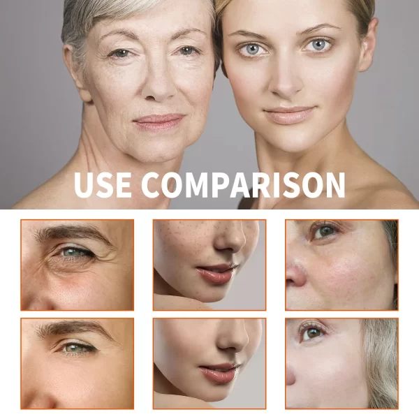 Removedor de Rugas Colágeno Soro Facial, Anti Envelhecimento, Levantamento, Refirmante, Essência, Linhas Finas Desvanecimento, Clareamento, Hidratante, Beleza, Cuidados com a pele - Image 3
