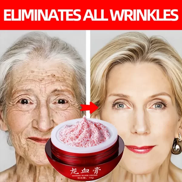 Creme rejuvenescedor, Placenta Essence Dragon's Blood Face Cream, Lift Firming, remover rugas, anti-envelhecimento, beleza, cuidados com a pele, cosméticos coreanos