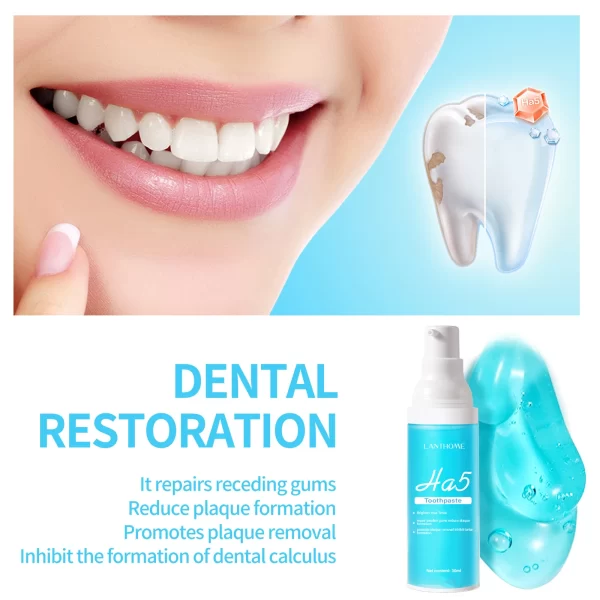 Creme dental, Dentes branqueamento, removedor rápido, manchas de placa, reparar cavidades, prevenir a periodontite, respiração fresca, iluminar, cuidados dentários - Image 5