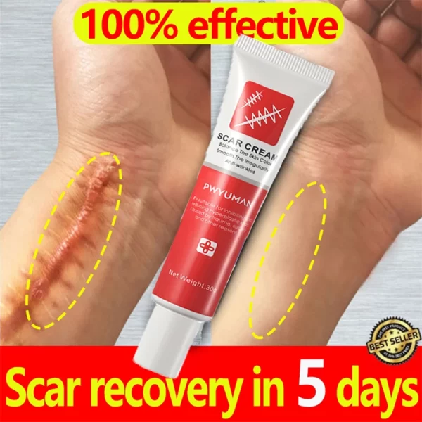 Creme de remoção rápida cicatriz, Reparação de estrias, Queimar Cirurgia, Tratar Gel, Acne, Pox, Pomada, Cuidados com a pele suave - Image 4
