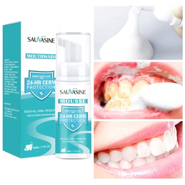 Creme dental, Dentes branqueamento, removedor rápido, manchas de placa, reparar cavidades, prevenir a periodontite, respiração fresca, iluminar, cuidados dentários - Image 9
