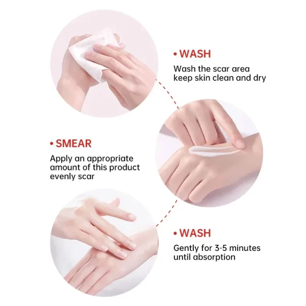 Creme de remoção rápida cicatriz, Reparação de estrias, Queimar Cirurgia, Tratar Gel, Acne, Pox, Pomada, Cuidados com a pele suave - Image 6